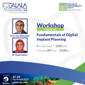 Fundamentals of Digital Implant Planning