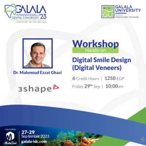 Digital Smile Design (Digital Veneers)